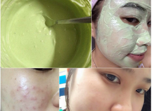 Bật mí loại mặt nạ dành cho da nhờn mụn lỗ chân lông to hiệu quả khiến chị em mê mẩn